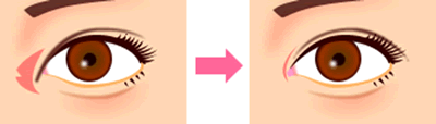fig1
